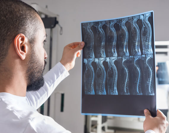Spinal Cord Injury Attorney