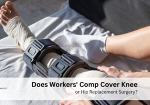 Does Workers' Comp Cover Knee or Hip Replacement Surgery