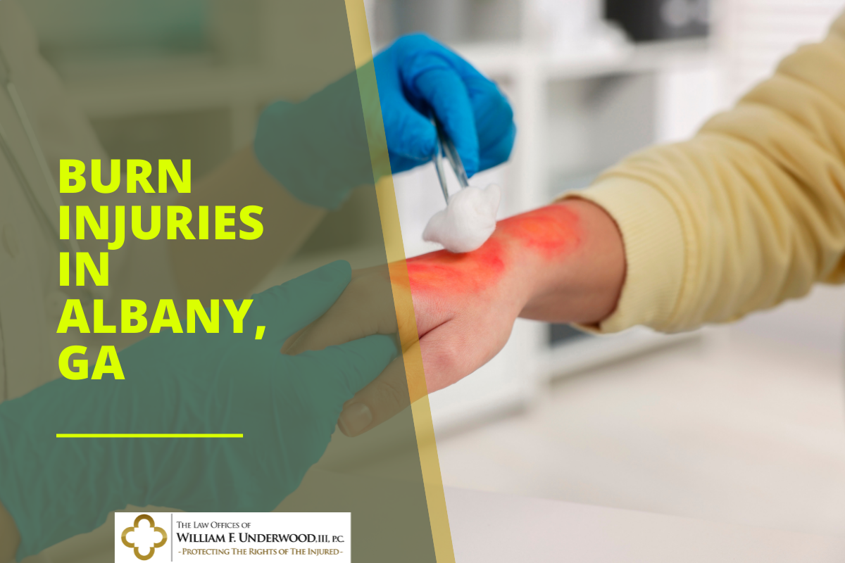 albany burn injury lawyer