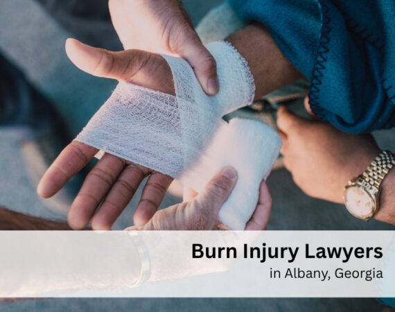 Burn Injury Lawyers in Albany, Georgia